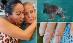 Rus kadın denizde caretta carettanın saldırısına uğradı