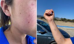 Seyir halindeki araçtan atılan torpilden kopan parçalar, kollarına ve yüzlerine isabet etti