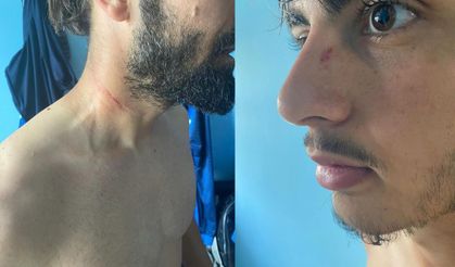 Kestelspor, Siirt’te ölümden döndü: Resmen futbol terörü!